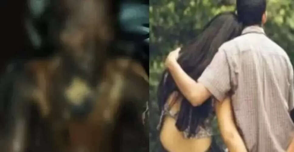 सिद्धार्थनगर में पत्नी ने पति को आग लगाकर किया हत्या का प्रयास