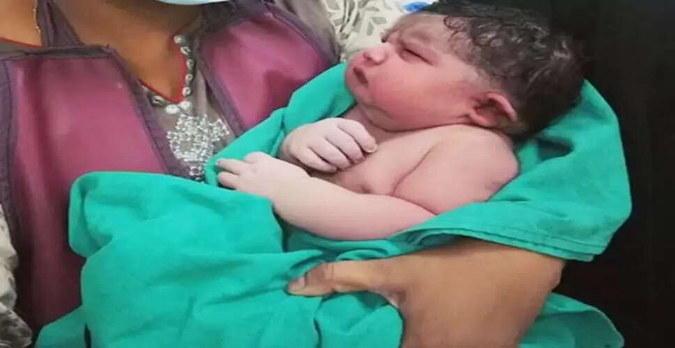 असम में जन्मा 5.2 किलो का बच्चा, डॉक्टर भी हैरान