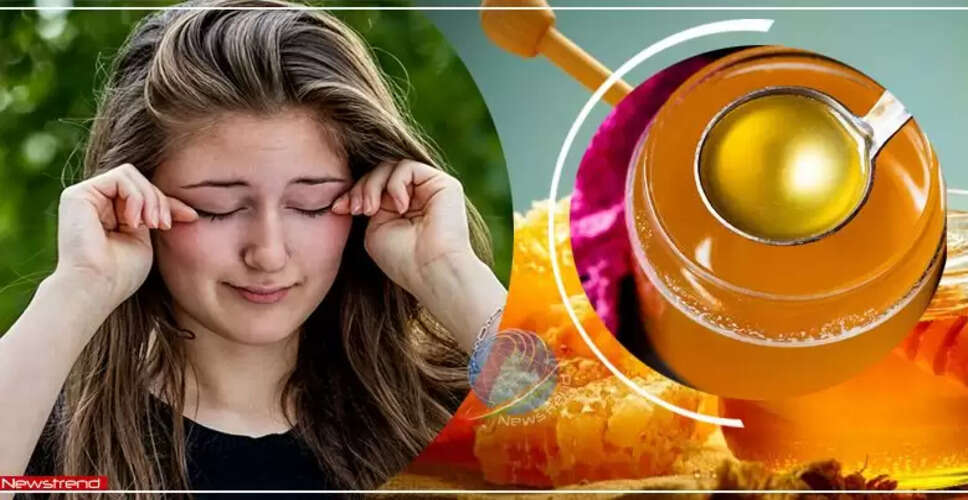 आंखों की खुजली से राहत पाने के घरेलू उपाय