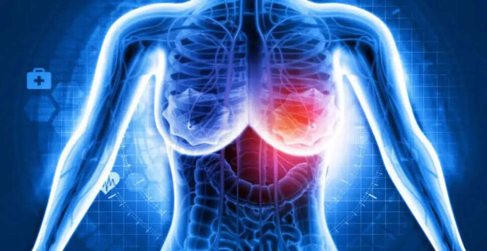 स्तन कैंसर के ग्रेड 1 के बारे में जानें: लक्षण, पहचान और उपचार