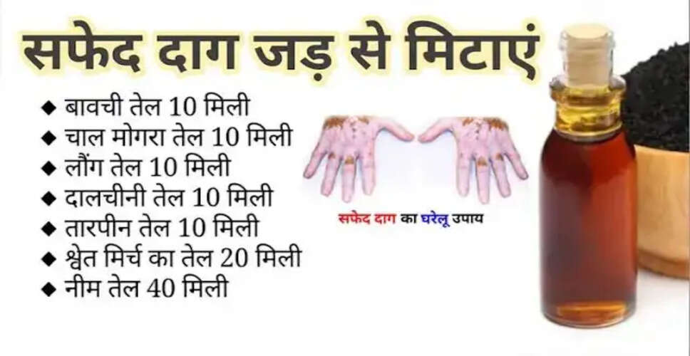 सफेद दाग: कारण, उपचार और घरेलू उपाय