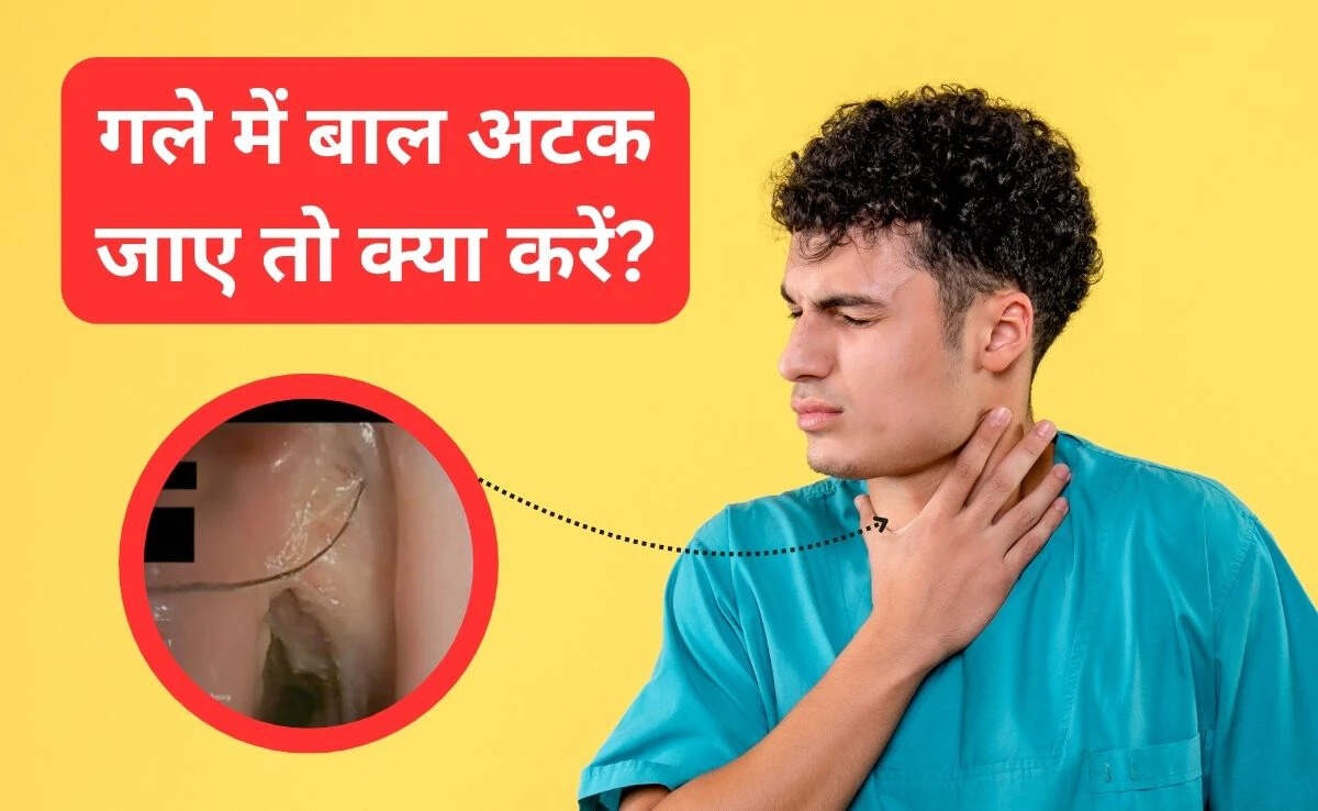 गले में फंसे बाल को निकालने के आसान घरेलू उपाय