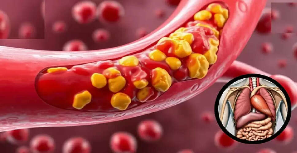 कोलेस्ट्रॉल के बढ़ने से होने वाले स्वास्थ्य जोखिम