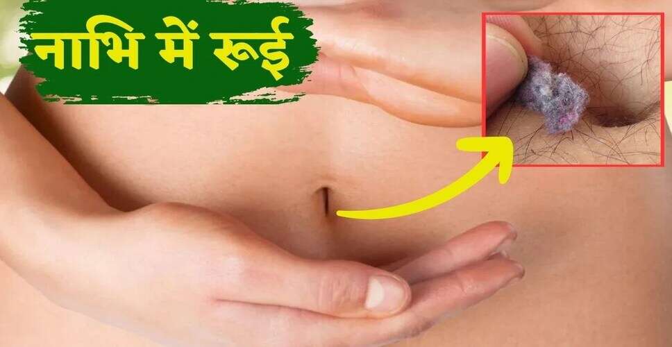 नाभि में रूई: कारण और देखभाल के तरीके