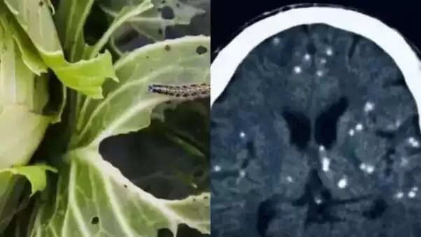 उत्तर प्रदेश में न्यूरोसिस्टी सारकोसिस के बढ़ते मामले: बच्चों में सावधानी आवश्यक