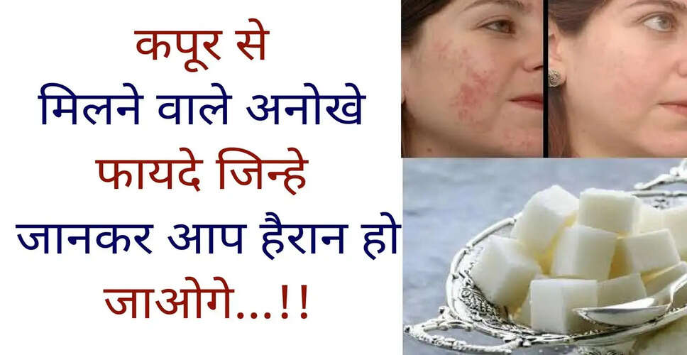 कपूर के अद्भुत स्वास्थ्य लाभ: जानें कैसे करें उपयोग