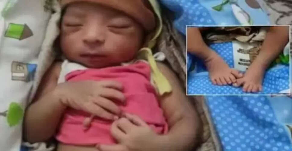 तेलंगाना में जन्मा अनोखा बच्चा, दोनों हाथों और पैरों में 24 उंगलियां
