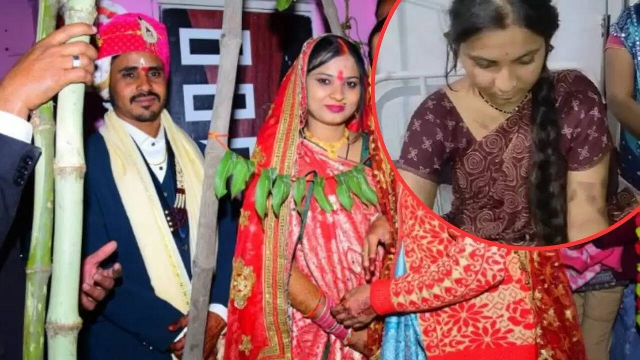 मध्य प्रदेश में दहेज के लिए पति ने पत्नी पर किया बर्बर हमला