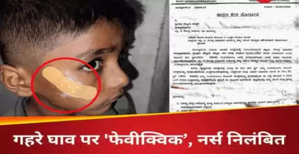 कर्नाटक में नर्स का निलंबन: बच्चे के घाव पर फेवीक्विक लगाने का मामला