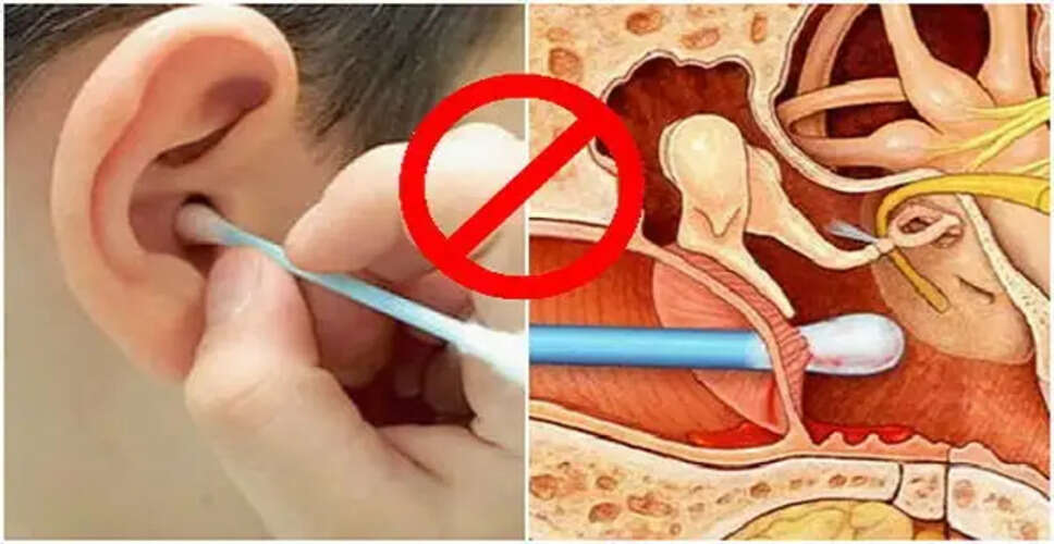 इयर बड का उपयोग: कान की सेहत के लिए खतरनाक