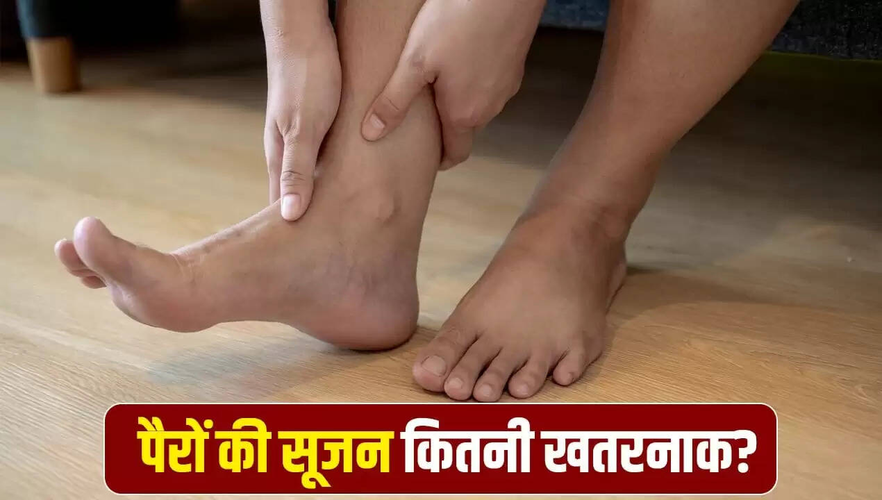 पैरों में सूजन: कारण, खतरे और बचाव के उपाय