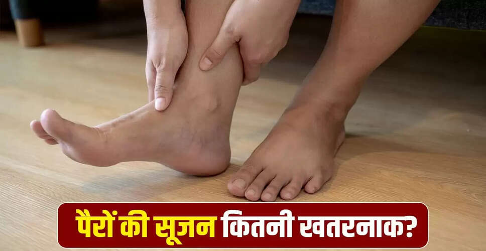 पैरों में सूजन: कारण, खतरे और बचाव के उपाय