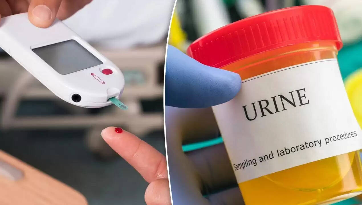 क्या यूरिन में जलन डायबिटीज का संकेत है? जानें विशेषज्ञ की राय