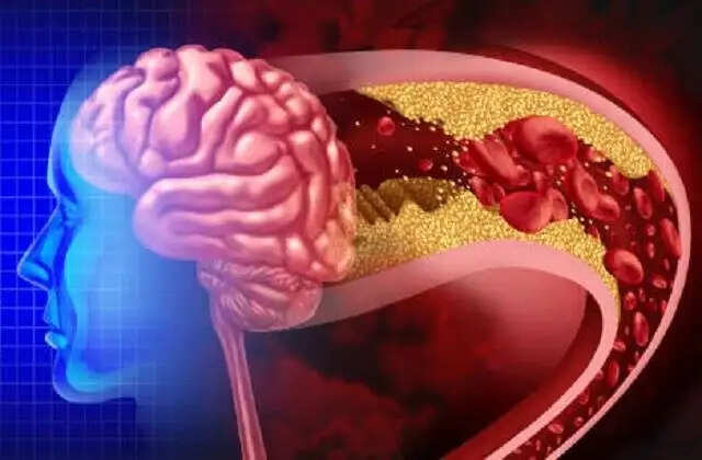 ब्रेन और नसों की समस्याओं के संकेत और समाधान