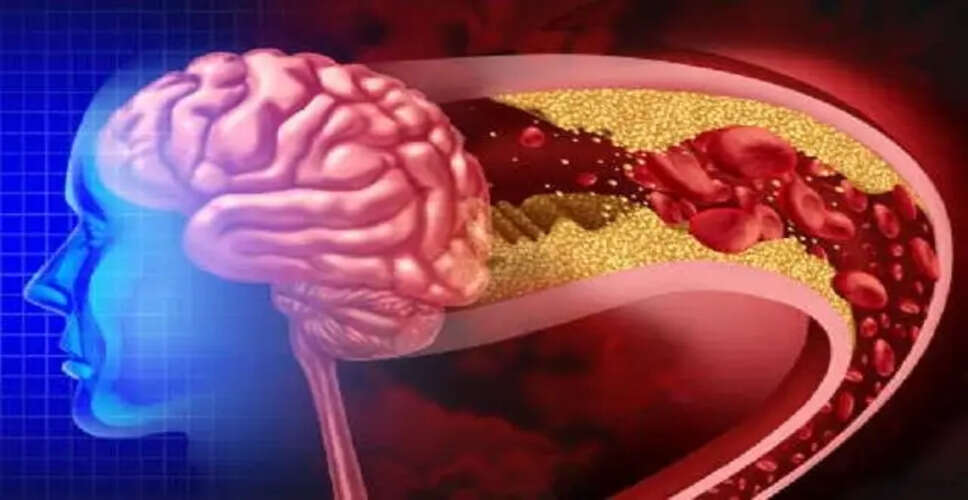 ब्रेन और नसों की समस्याओं के संकेत और समाधान