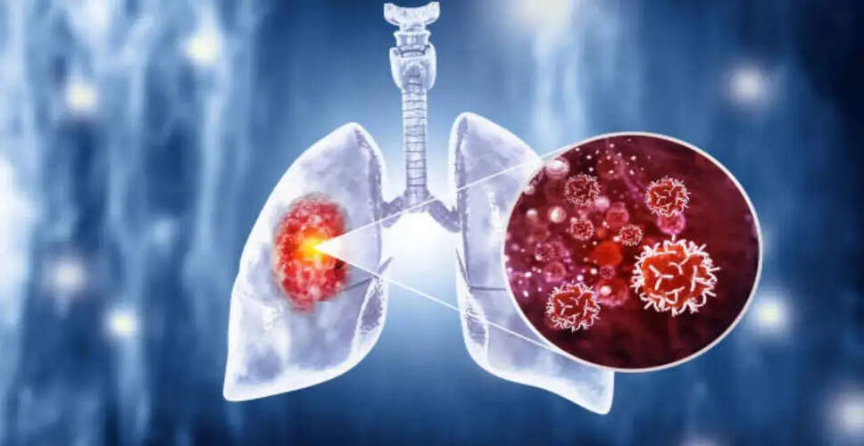 रक्त परीक्षण से फेफड़ों के कैंसर की भविष्यवाणी संभव