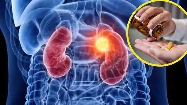किडनी स्वास्थ्य के लिए 4 प्राकृतिक चीजें जो आपको रोज़ाना खानी चाहिए