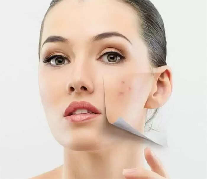 अजवाइन के अद्भुत फायदे: स्वास्थ्य समस्याओं का घरेलू इलाज