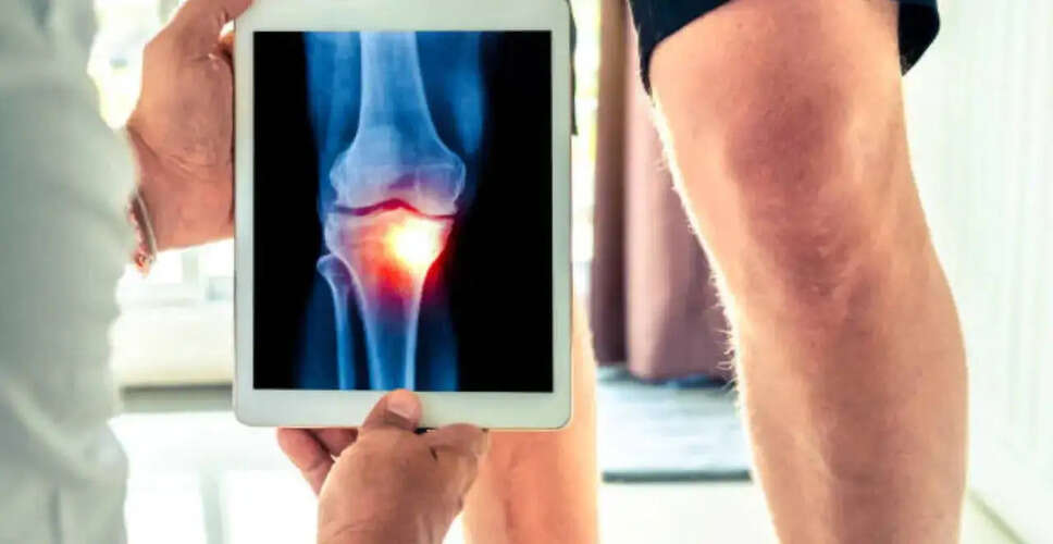 नवीनतम पुनर्जनन ऑर्थोपेडिक्स: सर्जरी के बिना उपचार के विकल्प