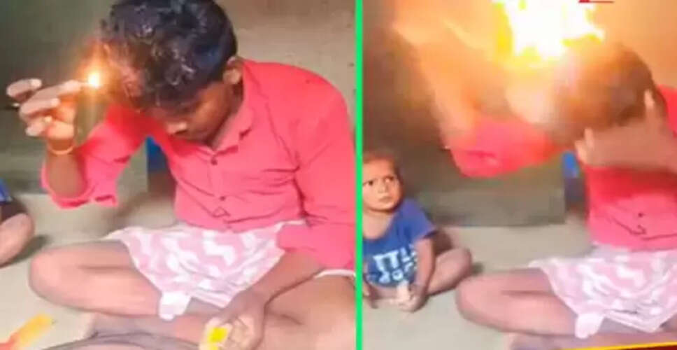 खतरनाक हेयर स्टाइलिंग: युवक ने बालों में आग लगाई, वायरल वीडियो में दिखा खौफनाक स्टंट