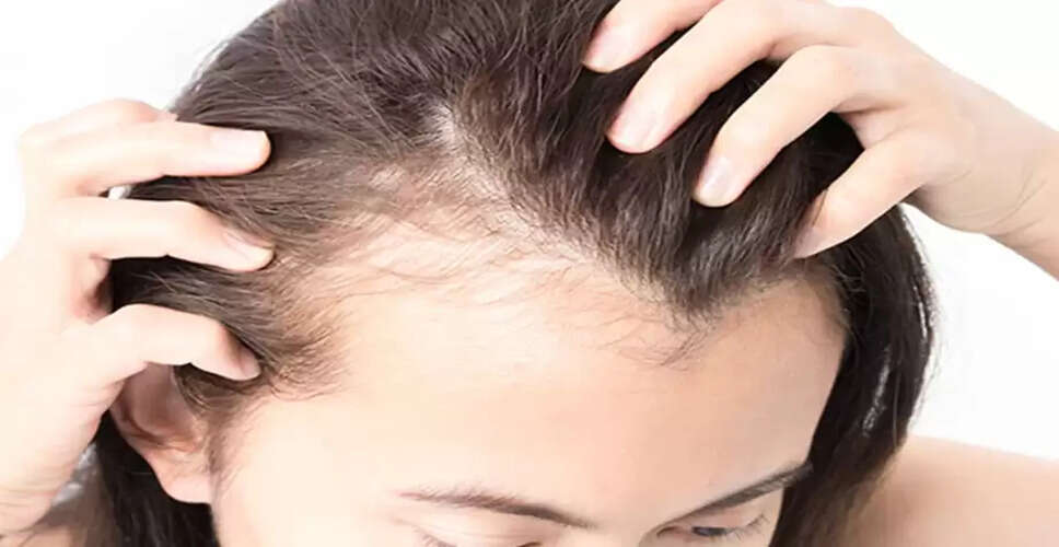 बालों के झड़ने के कारण और रोकथाम के उपाय