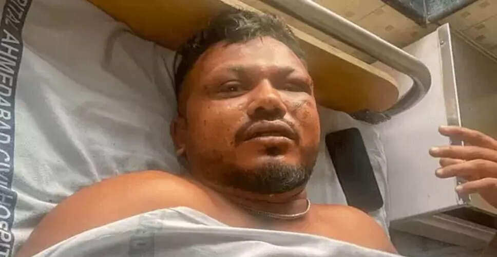 अहमदाबाद विमान दुर्घटना: एकमात्र जीवित बचे यात्री की कहानी