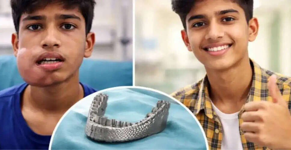 3D प्रिंटेड जबड़े के इम्प्लांट से लड़के की जिंदगी में आया बदलाव