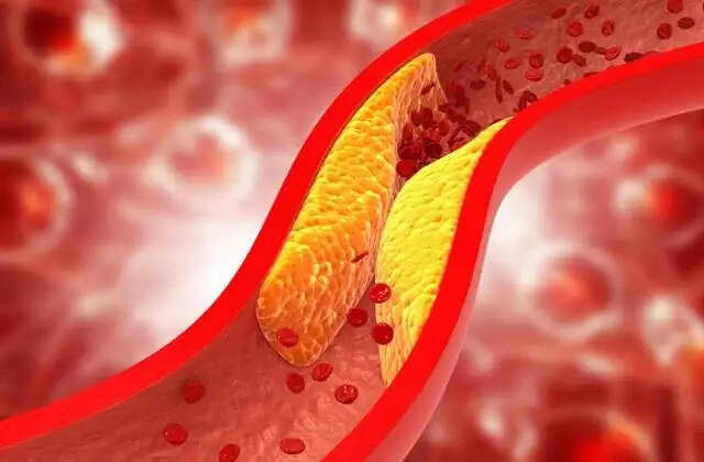कोलेस्ट्रॉल कम करने के लिए फलों का महत्व