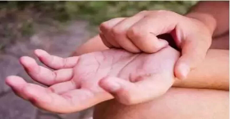 अमेरिका में खुजली वाले हाथ से बनी करोड़पति की कहानी