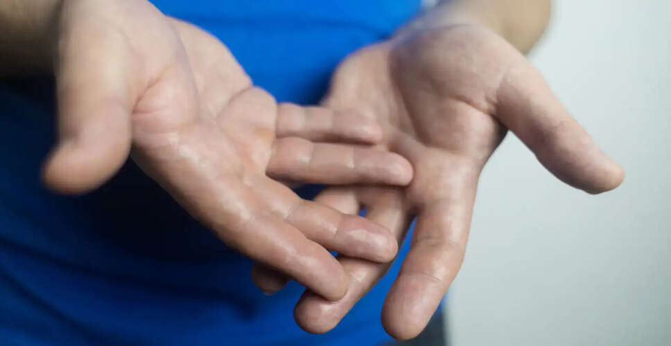 हाथों की कमजोरी और पसीने की समस्या: जानें क्या कहते हैं विशेषज्ञ