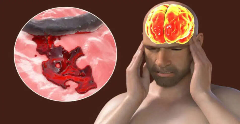 केरल में अमीबिक मेनिन्गोएन्सेफलाइटिस का स्वास्थ्य अलर्ट