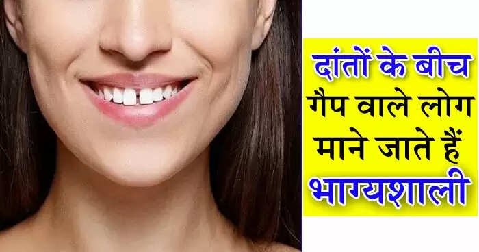 दांतों में गैप वाले लोगों की विशेषताएं और उनके स्वभाव