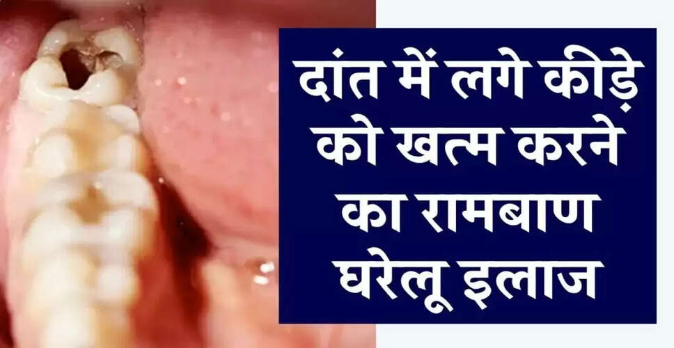 दांतों के कीड़ों से राहत पाने के घरेलू उपाय