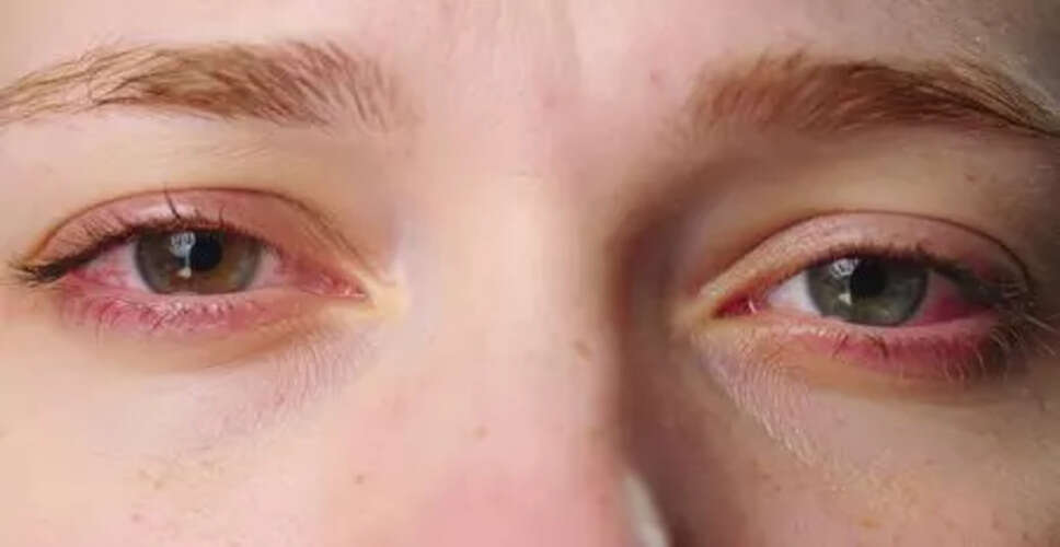 दिल्ली में वायु प्रदूषण से आंखों की समस्याओं में वृद्धि