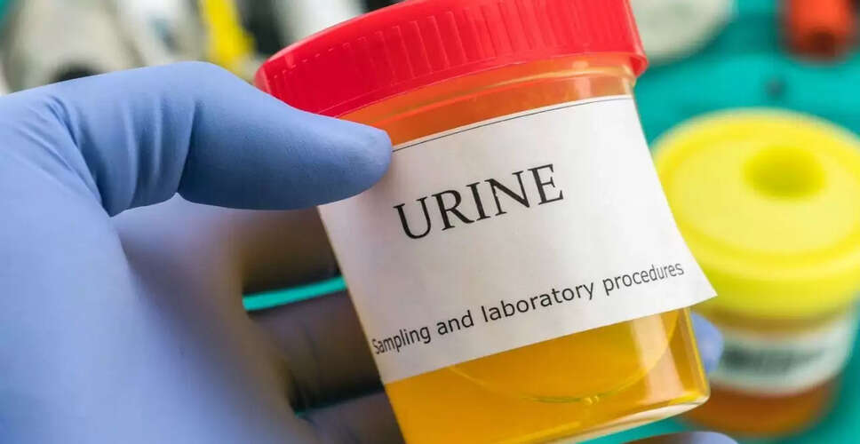 सर्दियों में पेशाब के रंग में बदलाव: जानें इसके कारण और सावधानियाँ