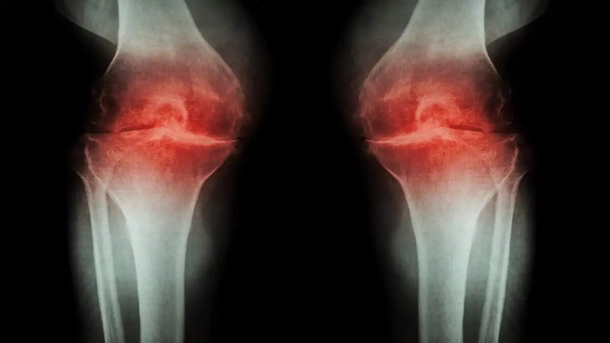 तनाव और चिंता का हड्डियों पर प्रभाव: जानें कैसे बचें