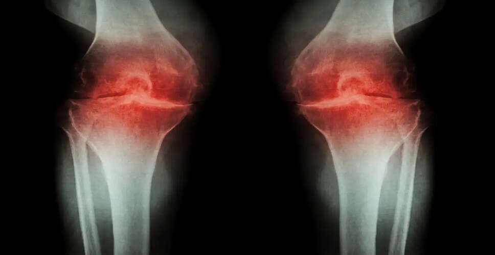 तनाव और चिंता का हड्डियों पर प्रभाव: जानें कैसे बचें