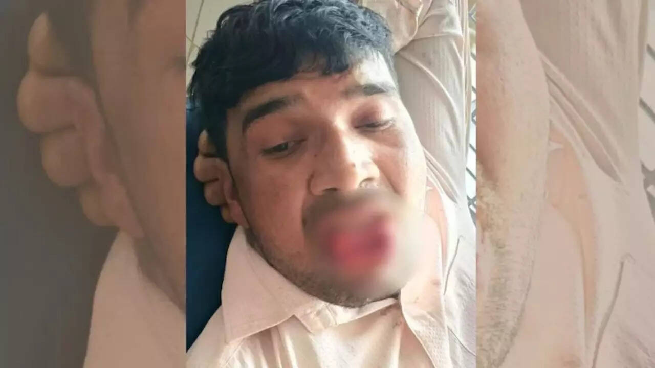 कानपुर में पूर्व प्रेमिका ने शादीशुदा युवक की जीभ काटी