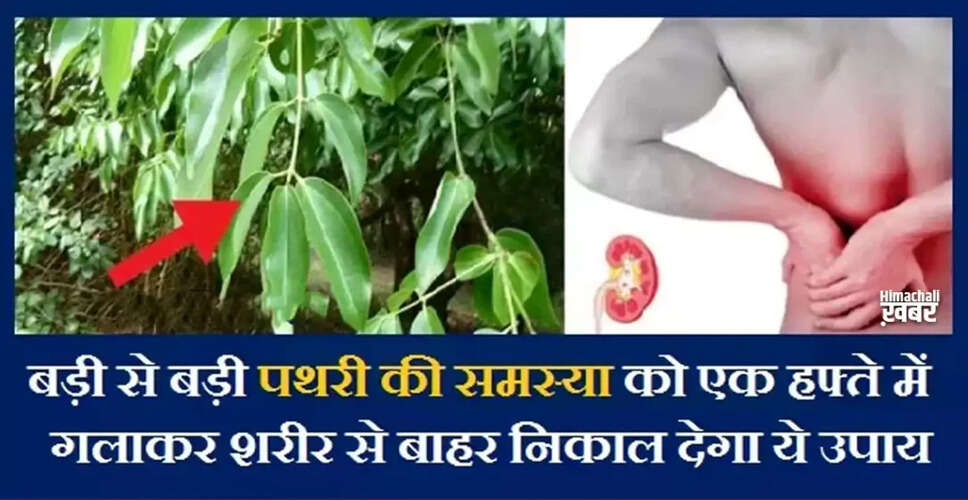 पथरी की समस्या: घरेलू उपाय और सावधानियाँ