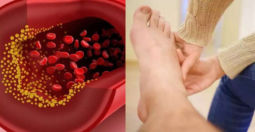 हाई कोलेस्ट्रॉल: जानें इसके कारण और नियंत्रण के उपाय