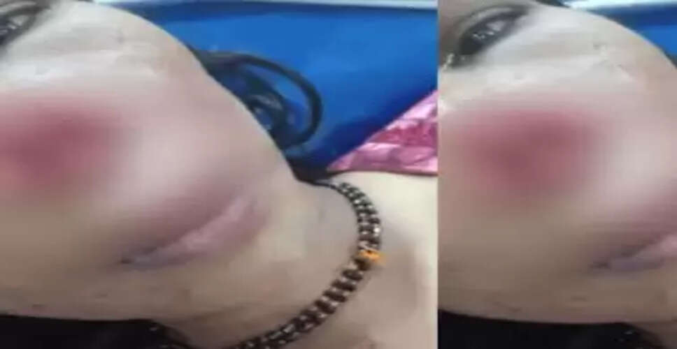 कर्नाटका में पत्नी की नाक काटने का चौंकाने वाला मामला