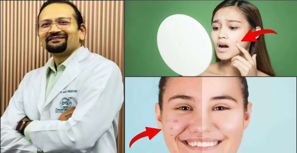 मॉनसून में त्वचा की देखभाल के लिए विशेषज्ञ के सुझाव