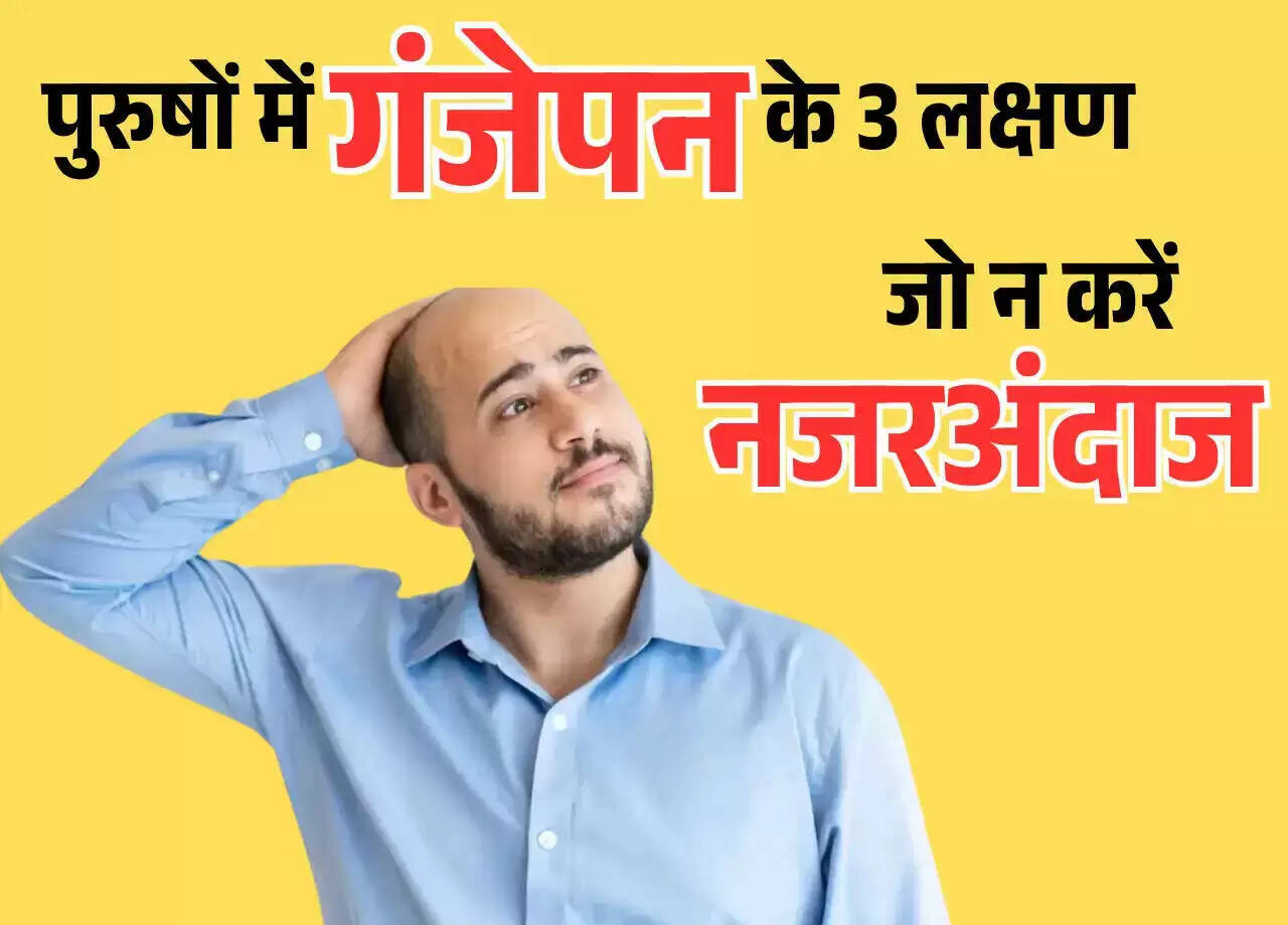 गंजेपन के संकेत: पुरुषों में पहचानें 3 प्रमुख लक्षण
