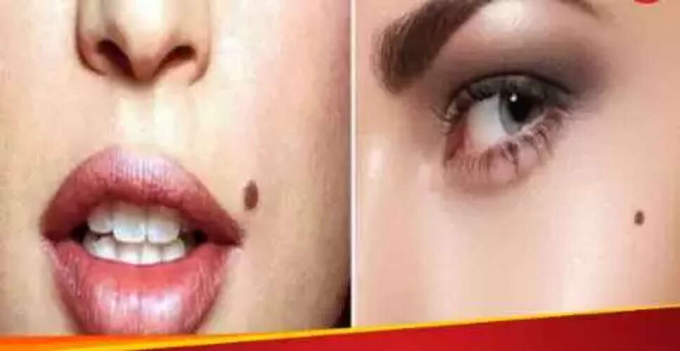 चेहरे पर तिल: भाग्य और समृद्धि के संकेत