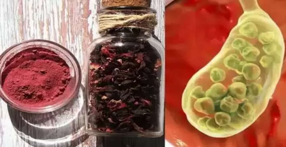 गुर्दे की पथरी के लिए गुड़हल का पाउडर: एक प्राकृतिक उपाय