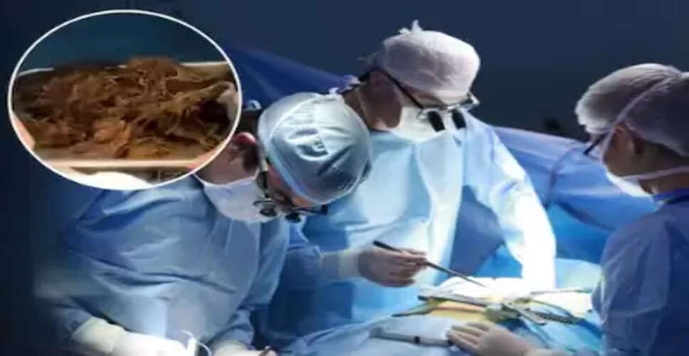 15 वर्षीय लड़की के पेट से निकला 2 किलो बालों का गुच्छा