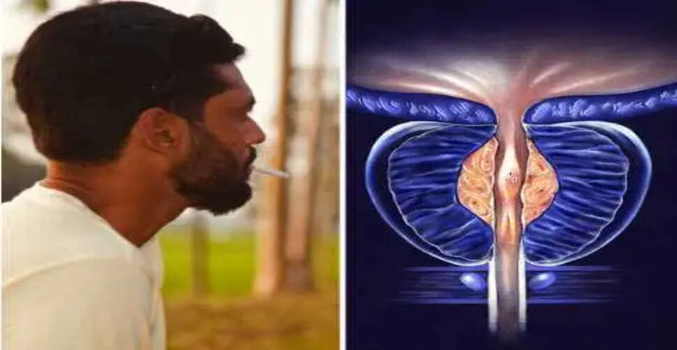 प्रोस्टेट कैंसर: 40 के बाद पुरुषों के लिए चेतावनी संकेत