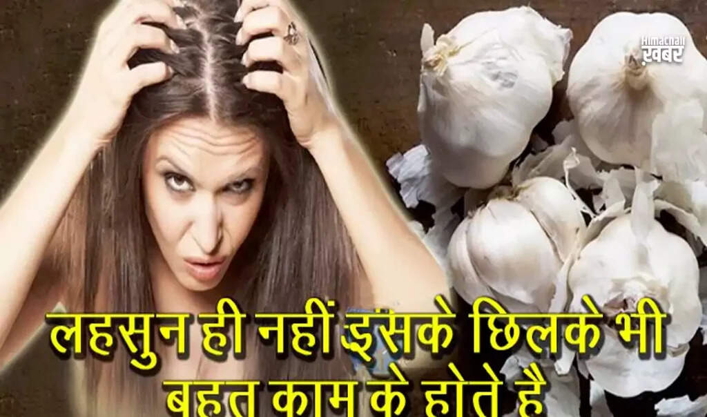 लहसुन के छिलकों के अद्भुत फायदे: स्वास्थ्य और सौंदर्य के लिए उपयोगी