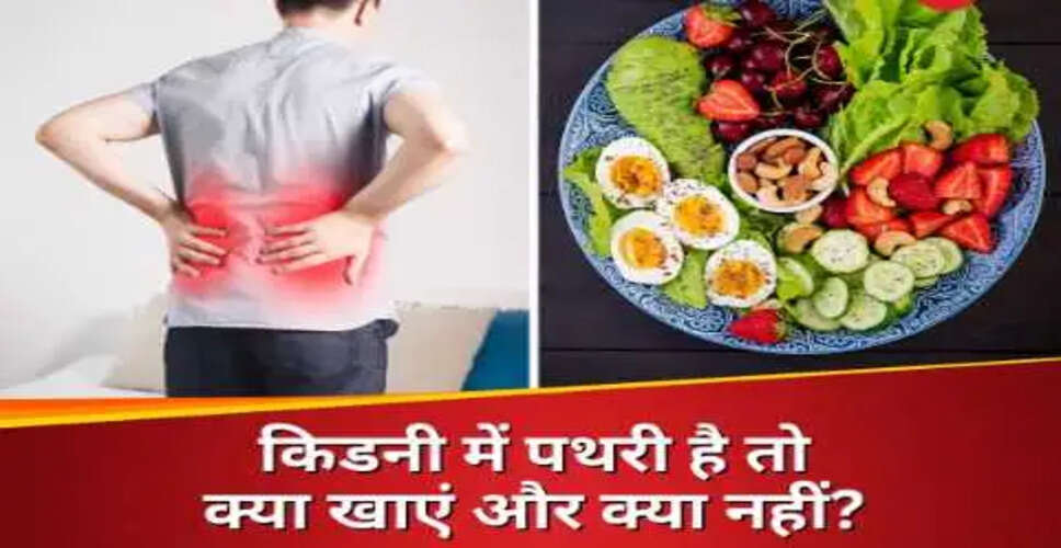 किडनी स्टोन से बचने के लिए सही खानपान और जीवनशैली
