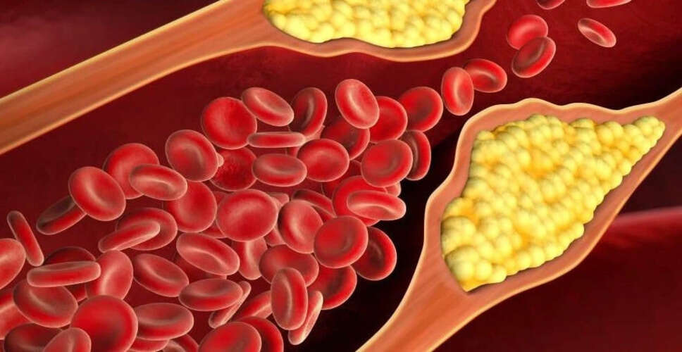 कॉलेस्ट्रोल कम करने के लिए प्रभावी ड्रिंक बनाने की विधि